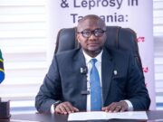 Jamii yaaswa kutowaficha wagonjwa wa ukoma